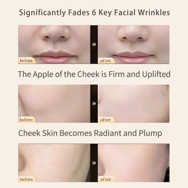 mu conotoxin cniiic rejuvenating and firming wrinkle reducing patch 12ml ×5 patches